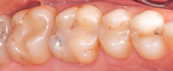 patient with failing teeth